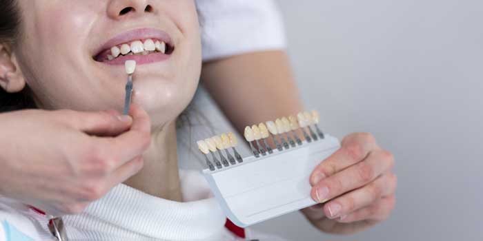 Dental Implant